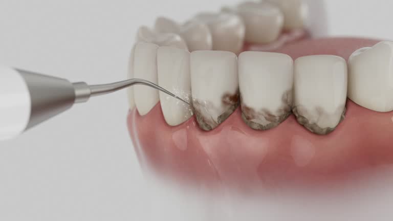 Reliable Dental Implants contractor in Winthrop, IA by Smile Center Dentistry